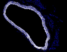 hydrozide_staining_aorta_cross_section.jpg